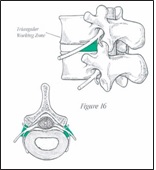 illustration of needle inserting the disc