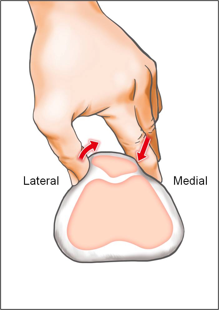 Patellar Tilt Test