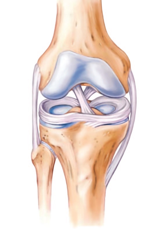 半月板常见问题撕裂 修复及移植 膝部 医生文章 亚洲专科医生