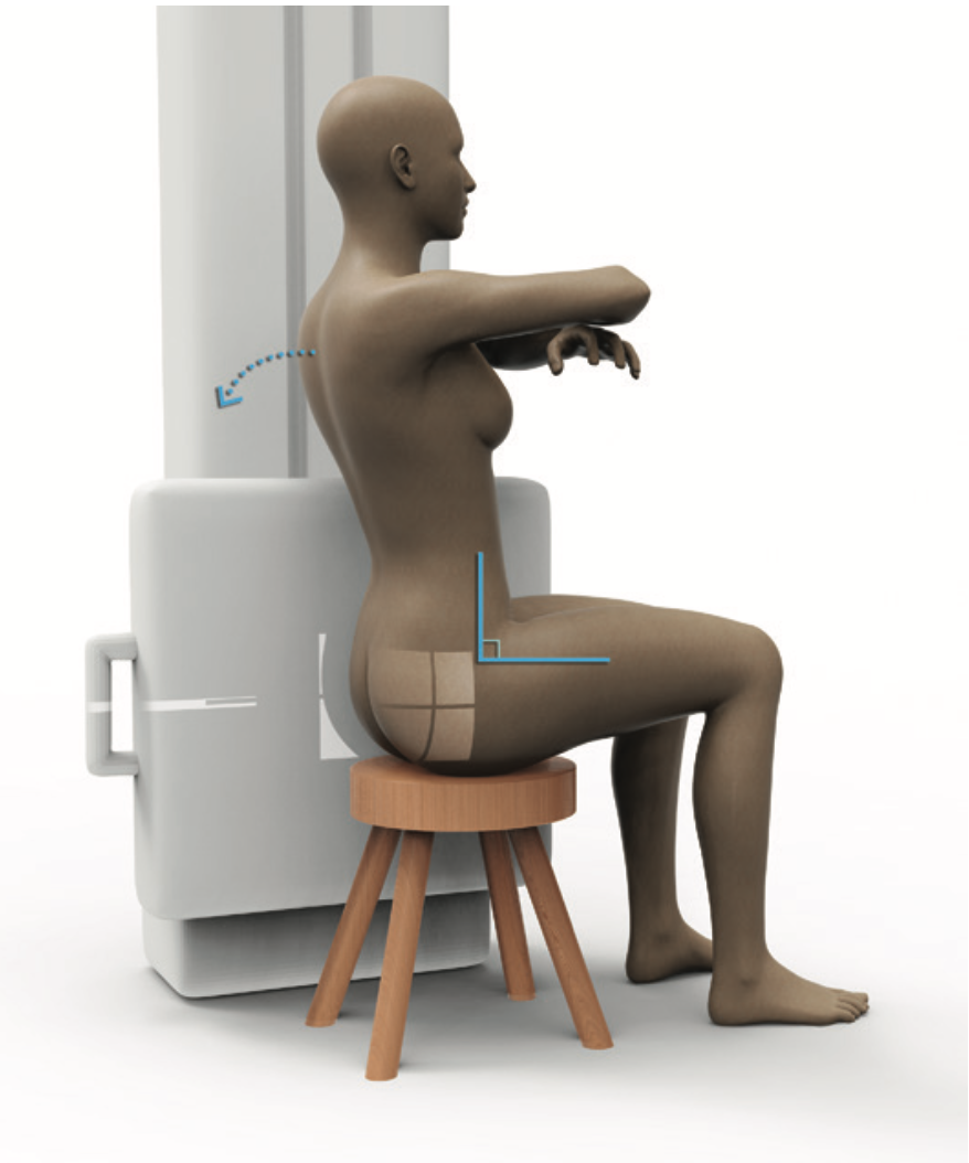 Fig2 Seated lateral coccyx X-ray