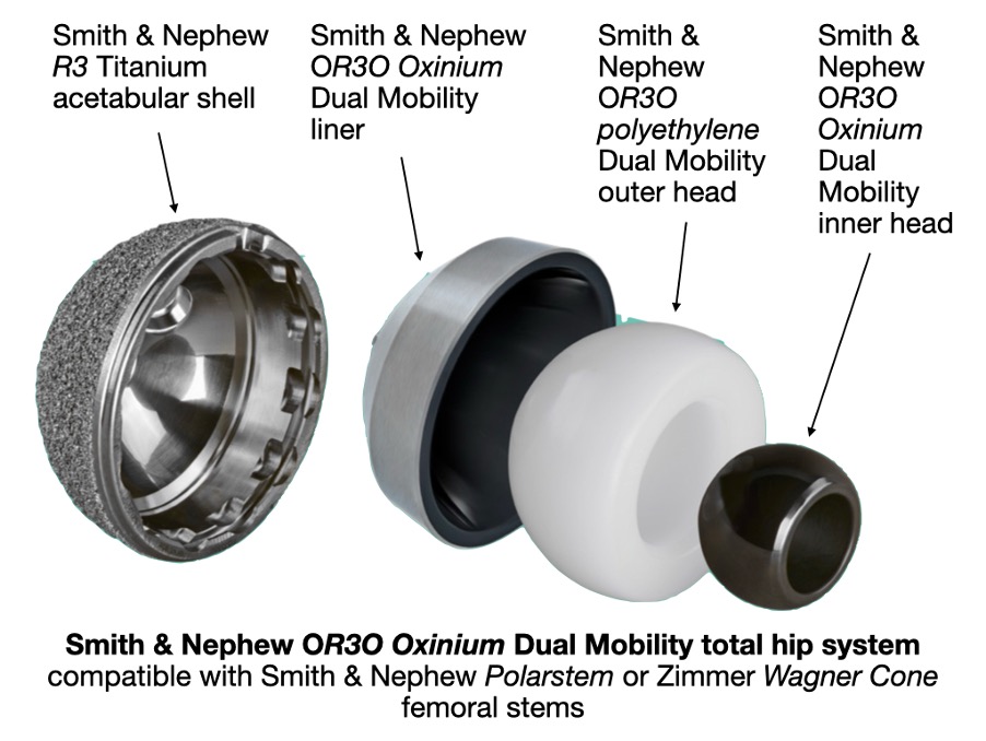 Comparison of different hip replacement systems