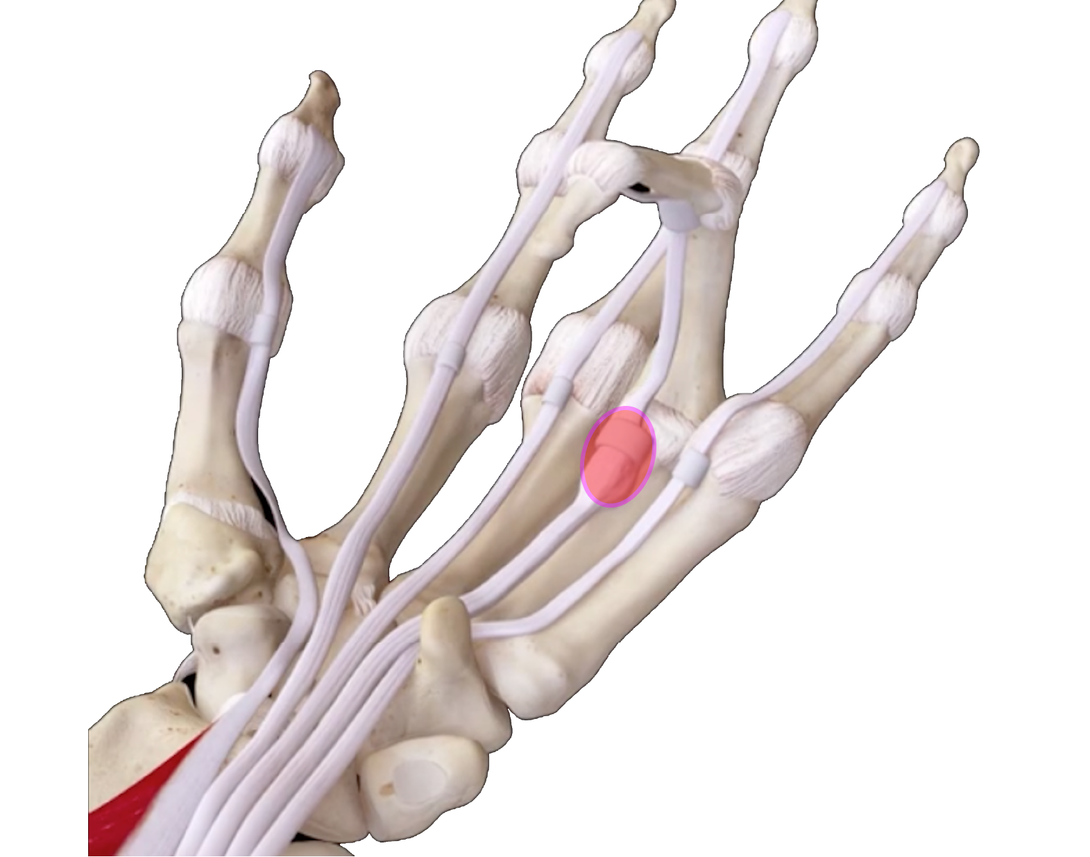 Trigger Finger anatomy